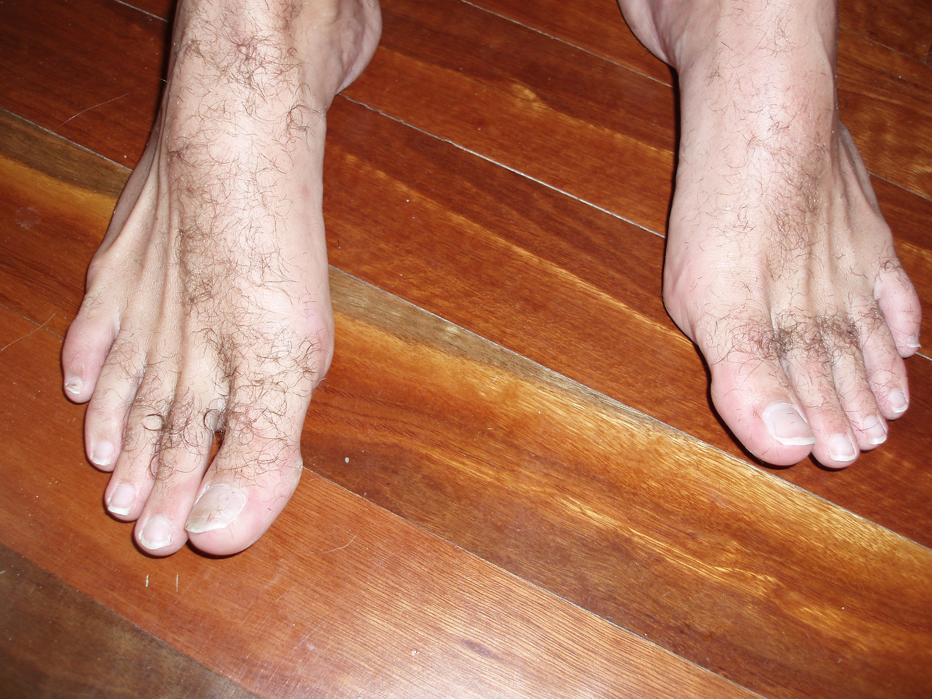 daryl burgh recommends hairy men feet pic